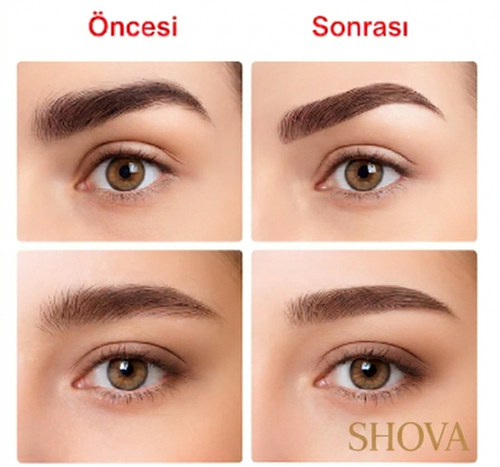 SHOVA Dokunuşu: Anında Pürüzsüz Cilt